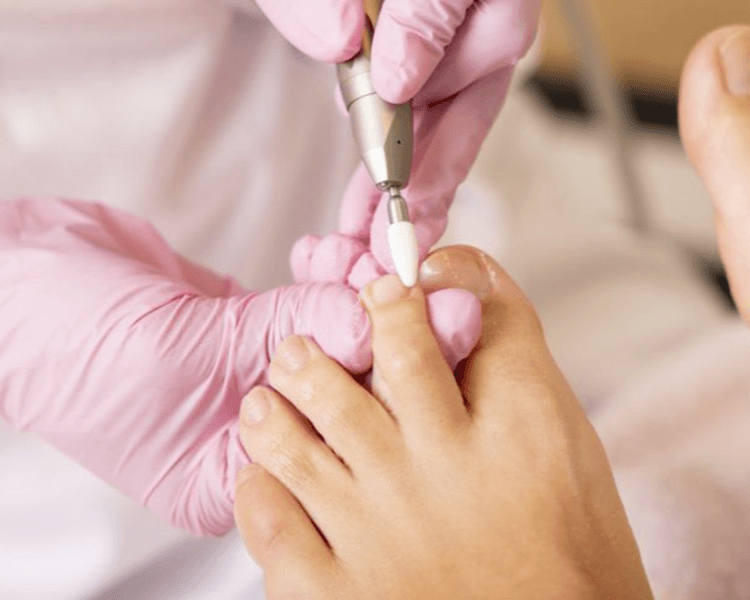 Pedicuria con Tratamiento Recuperador