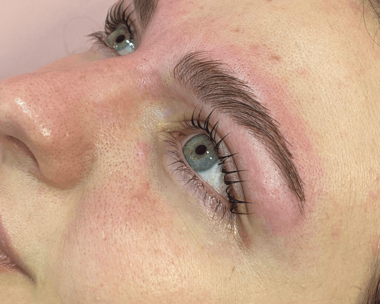 Combo Perfilado + Laminado + Lifting