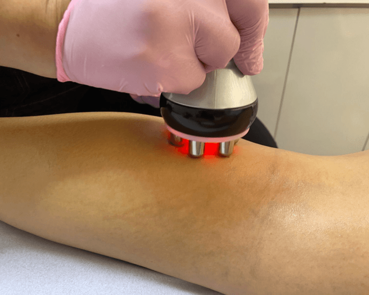 Tratamiento Anti Celulitis piernas y glutéos (1 sesión)