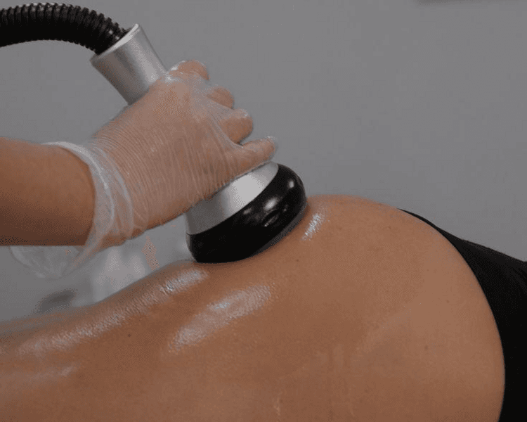 Tratamiento Anti Celulitis piernas y glutéos (4 sesiones)