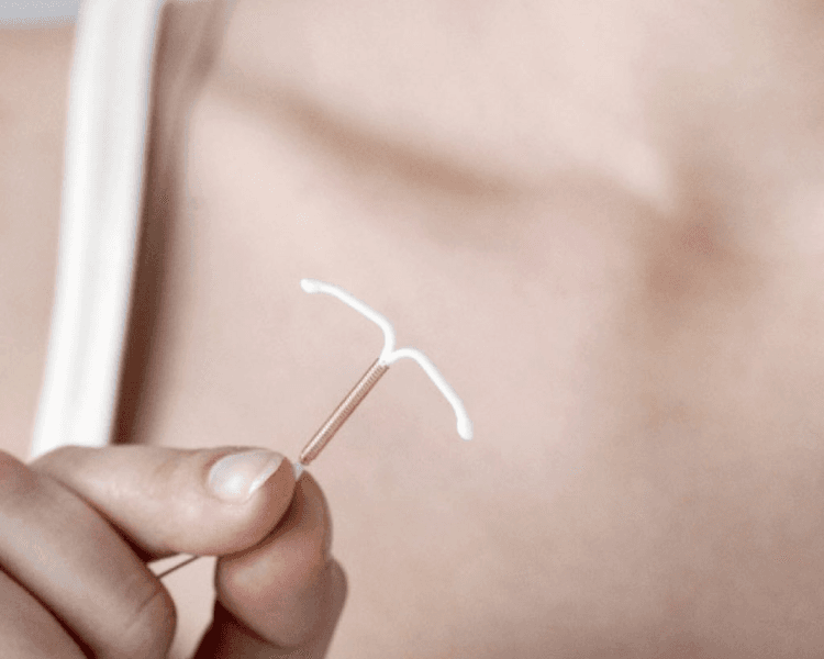 Inserción de DIU medicado(5 AÑOS) incluye el dispositivo