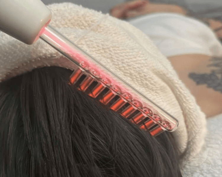 DERMAHAIR - Tratamiento para crecimiento y anti caida del cabello (1 sesión)