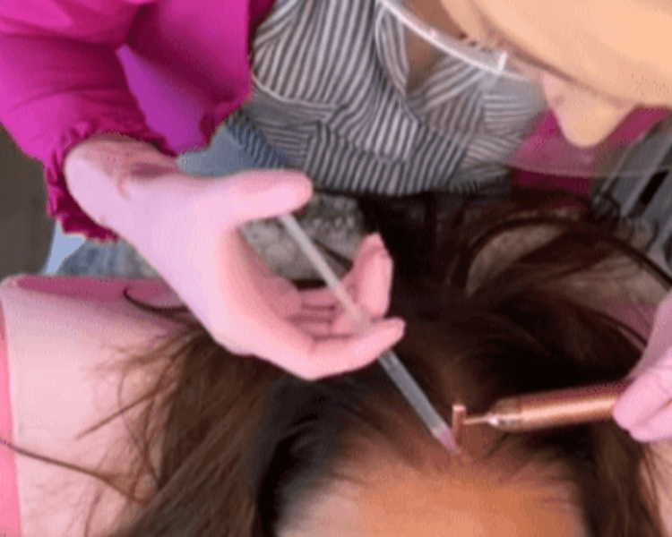 Microagujas cóctel HL - 3 sesiones