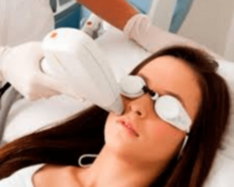 Tratamiento 6S Depilación facial