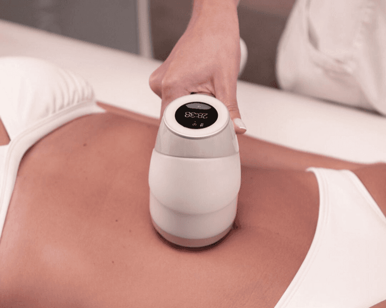 Crioradiofrecuencia / Himfu Abdomen y flancos