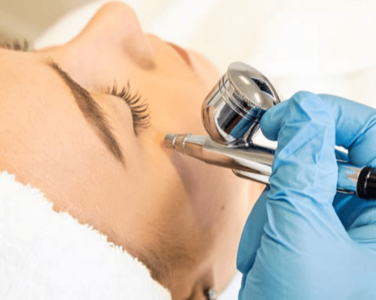 Oxigenoterapia facial ( 1 sesión)