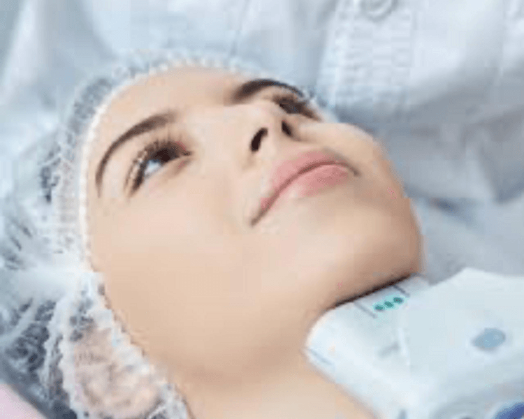 HIFU de Rostro, papada y cuello ( 2 sesiones)