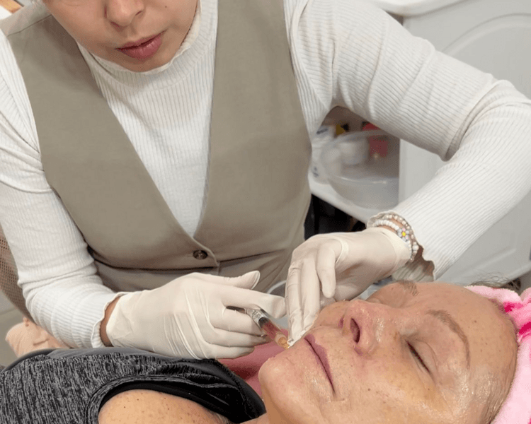 Hilos tensores: Monofilamento (x10)