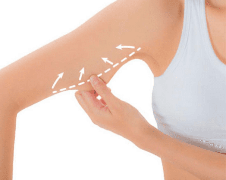 HIFU Brazos ( 1 sesion)