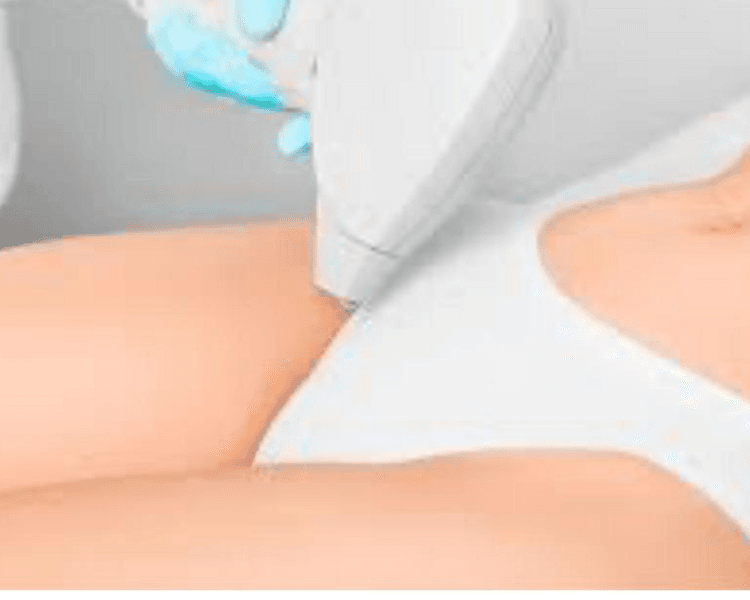 Bikini (mujer) 6 sesiones