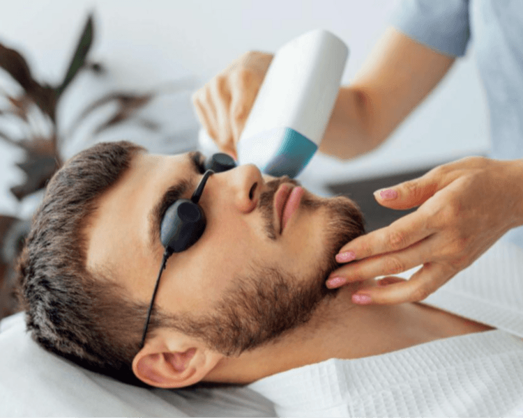 Perfilado de barba (hombre) 8 sesiones