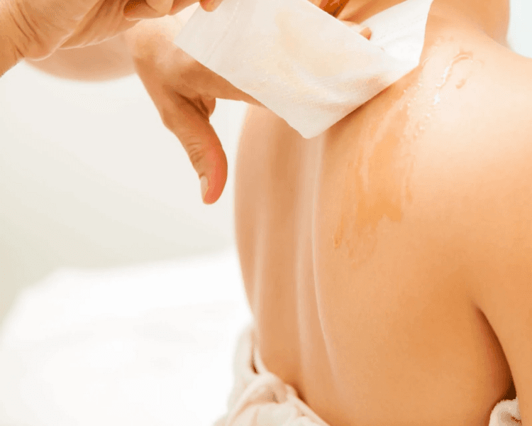 Depilación espalda completa