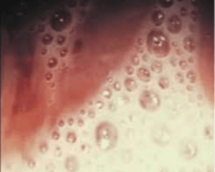 Toma de examenes Ginecológicos