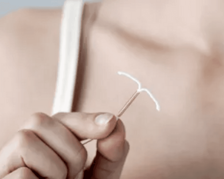 Inserción o recambio de Dispositivo intrauterino (inlcuye dispositivo Andalan variedades classic, silverflex, comfort, comfort mini)