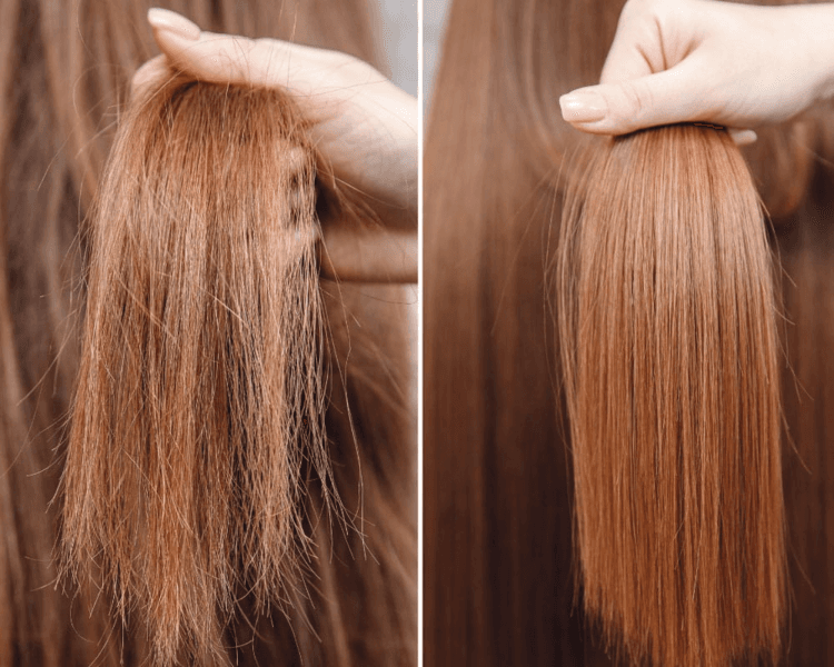 Bomba de hidratación