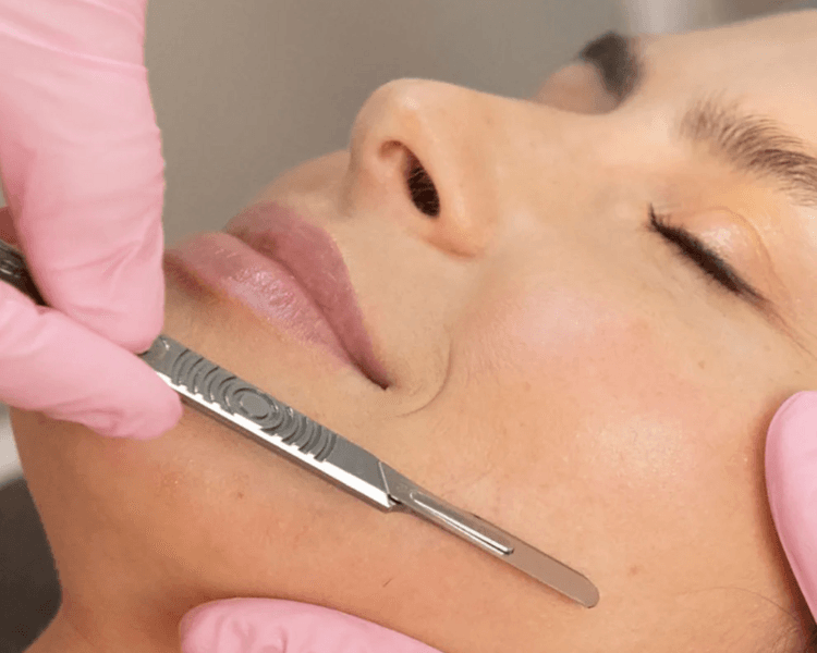 🗡️ Dermaplaning