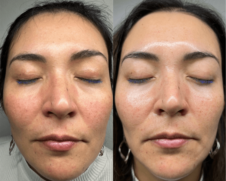 Radian C+ vitamina C NOVIAS/EVENTOS