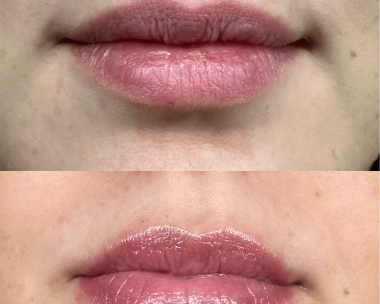 Hydralips hidratación de labios