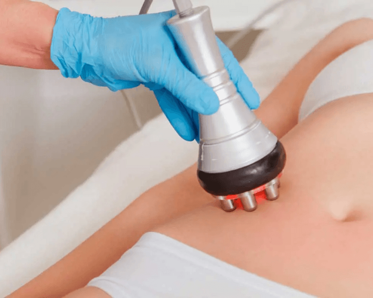 Tratamiento Reductivo Espalda y Brazos 15 Sesiones