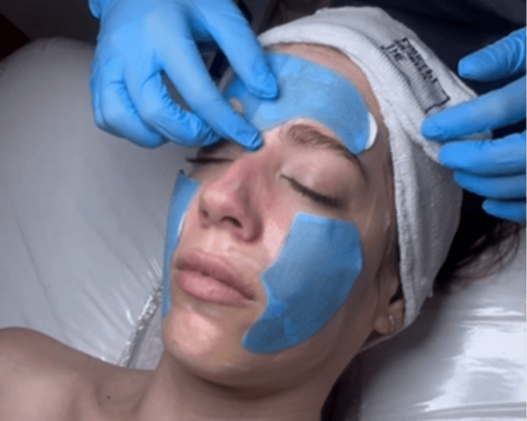 Limpieza Profunda + Shock de Colageno