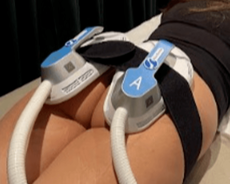 MIO UP (1 zona a elección )