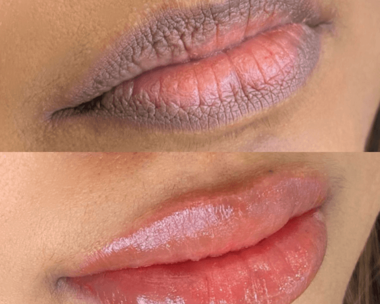 Micropigmentación de labios