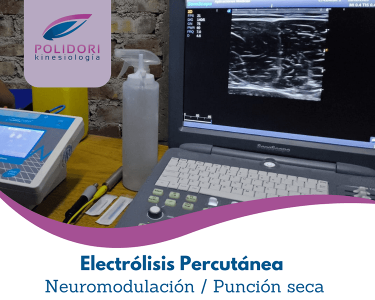Sesión de Electrolisis/ Neuro modulación/ Punción Seca