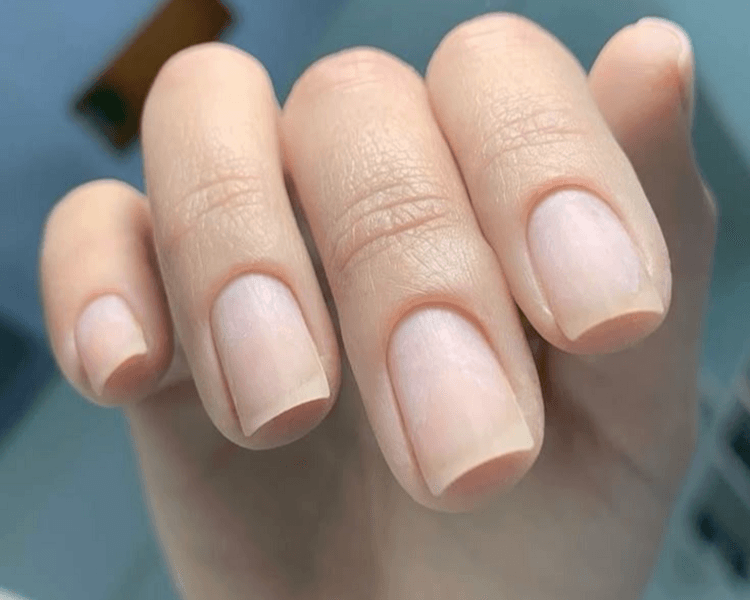 Retiro de Ruber Calcio o Acrílico