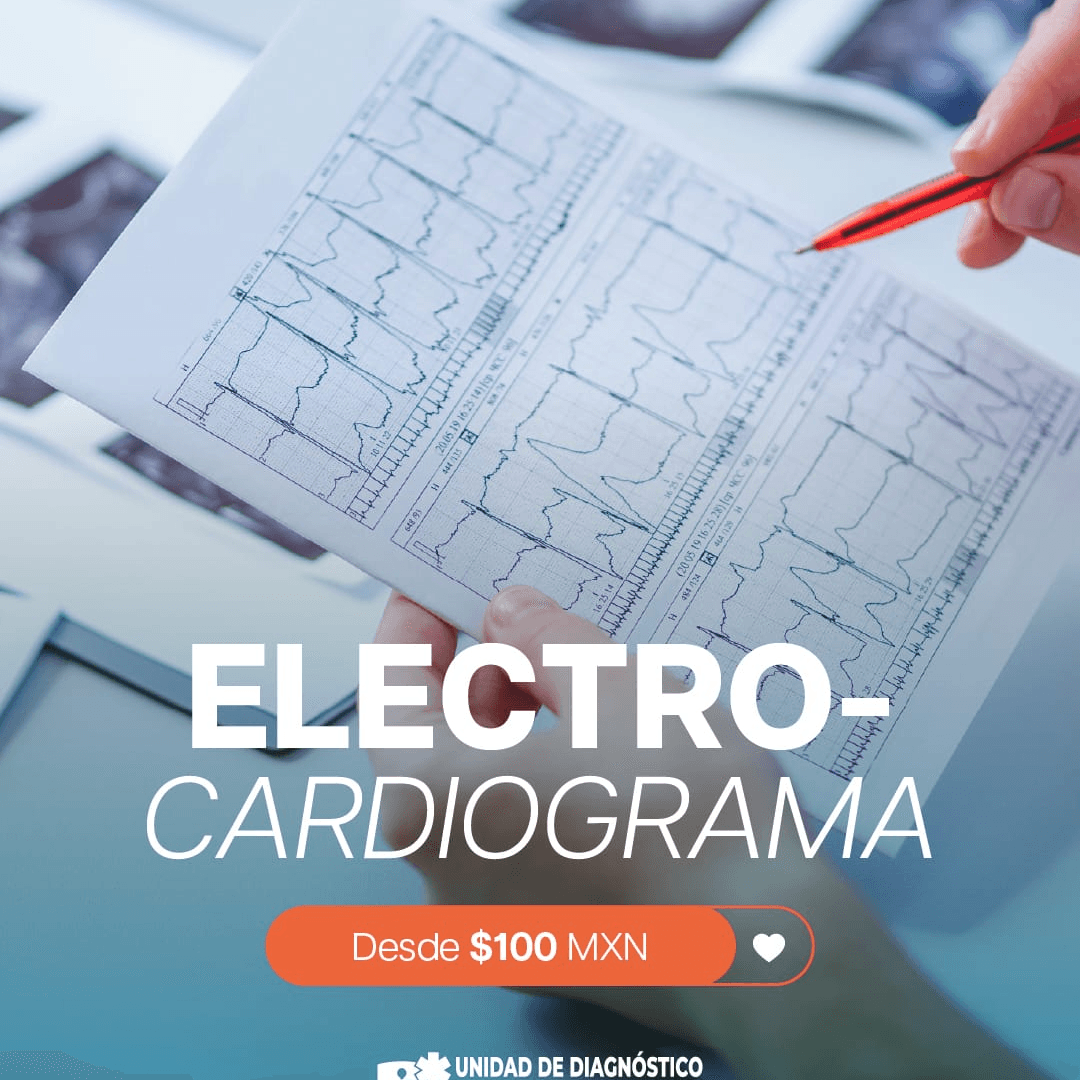 ELECTROCARDIOGRAMA photo
