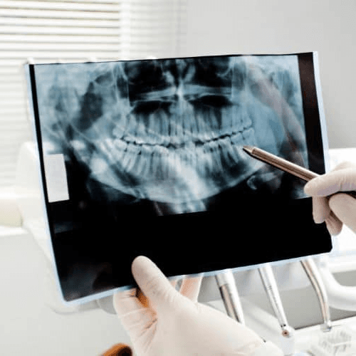 RAYOS X DENTALES photo