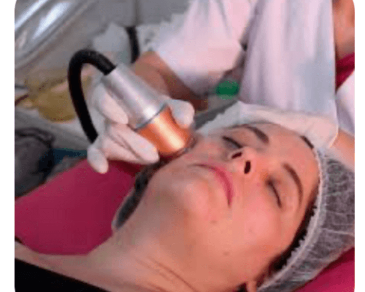 HIFU V-max o Lifting facial no invasivo