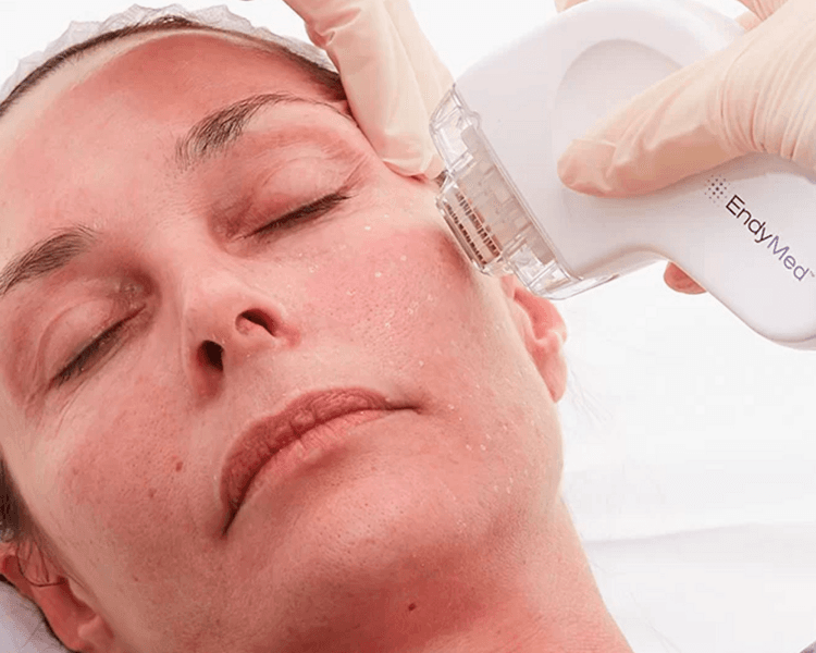 CABEZAL FSR 3 SESIONES