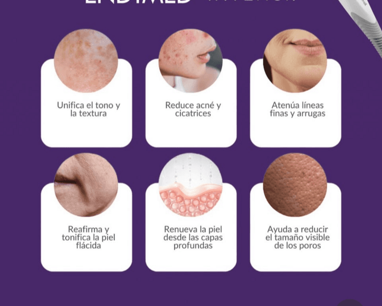 RADIOFRECUENCIA FRACCIONADA 3 SESIONES CABEZAL INTENSIF + FSR