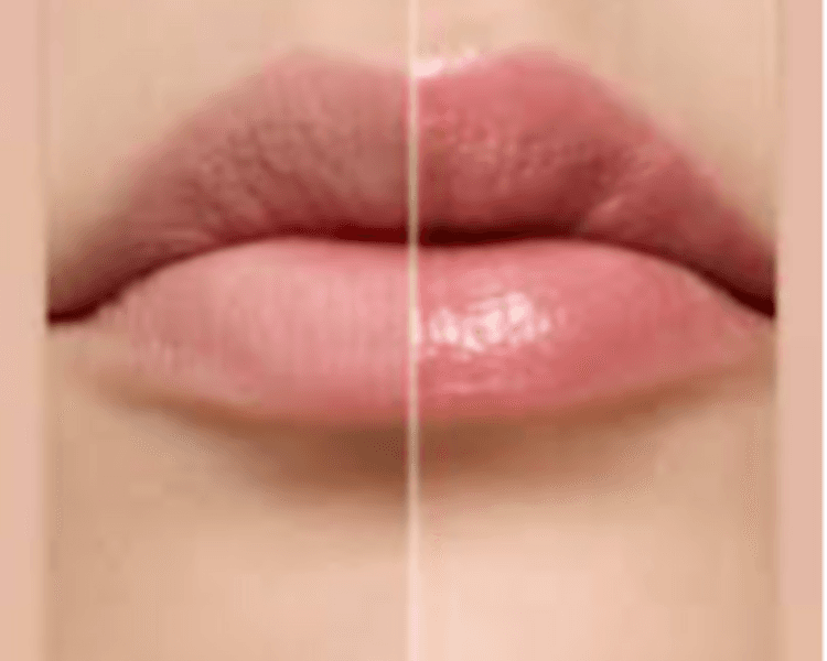 BBLIPS HIDRATACION DE LABIOS