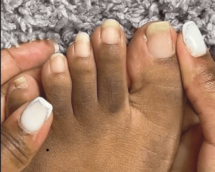 Retiro de Esmalte Semipermanente en pies incluye corte y limado de uñas