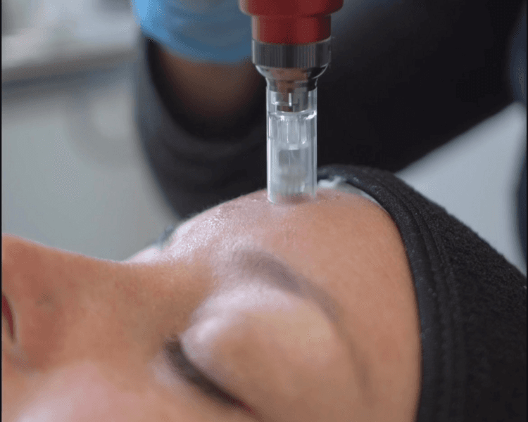 Tratamiento Pink Glow