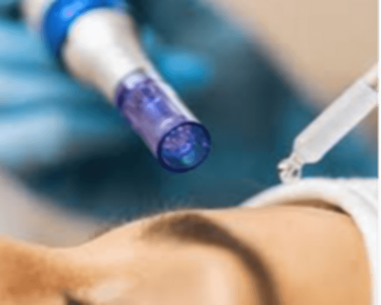 Limpieza Facial Hidratación #3