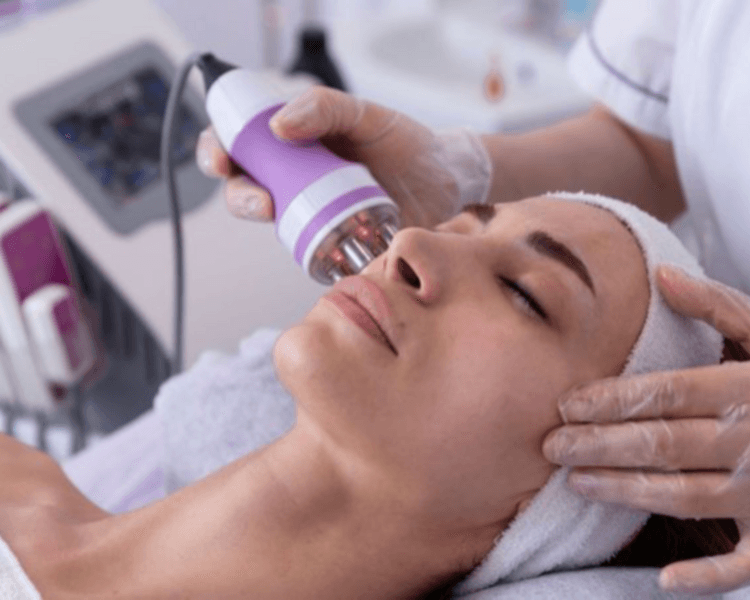 Tratamiento con radiofrecuencia