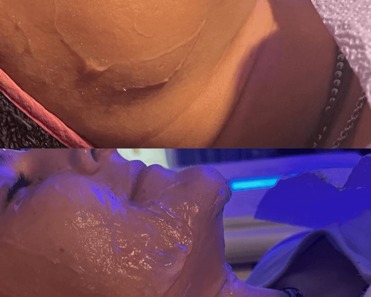 HIFU 12 PRO MAX FACIAL