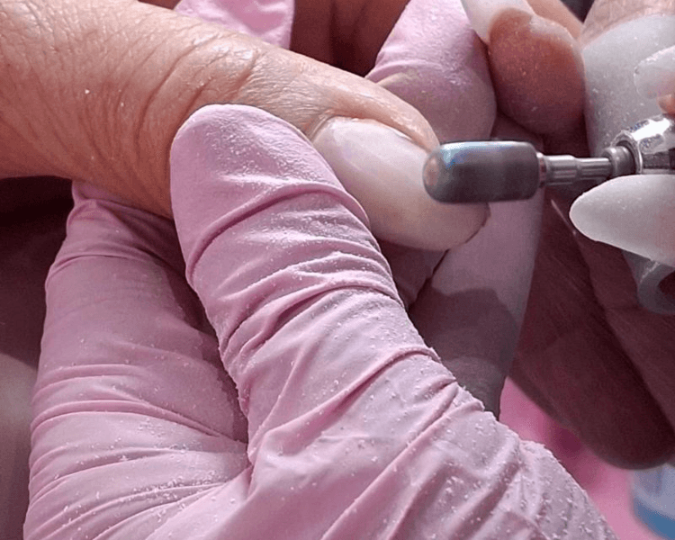 Retiro de Polygel o Acrílico