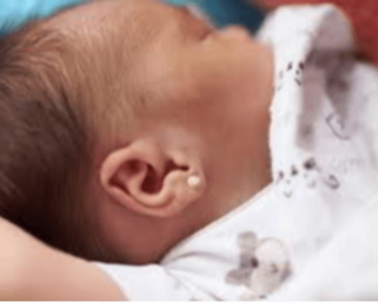 PERFORACIÓN PRIMEROS ARITOS RN (HASTA 2 MESES)