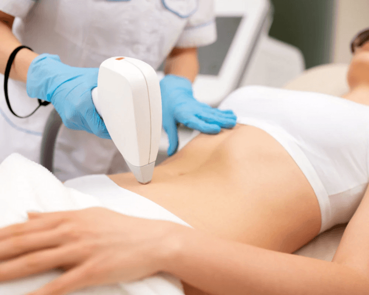 Depilación de Abdomen