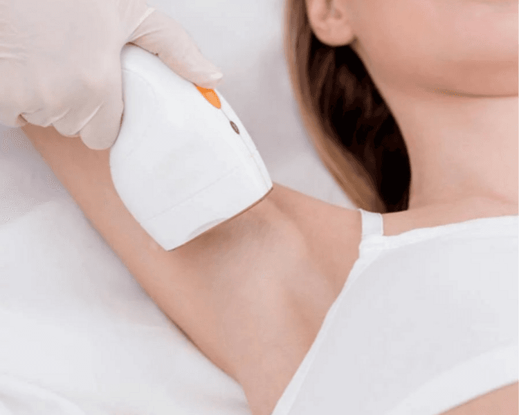 Depilación de Axilas