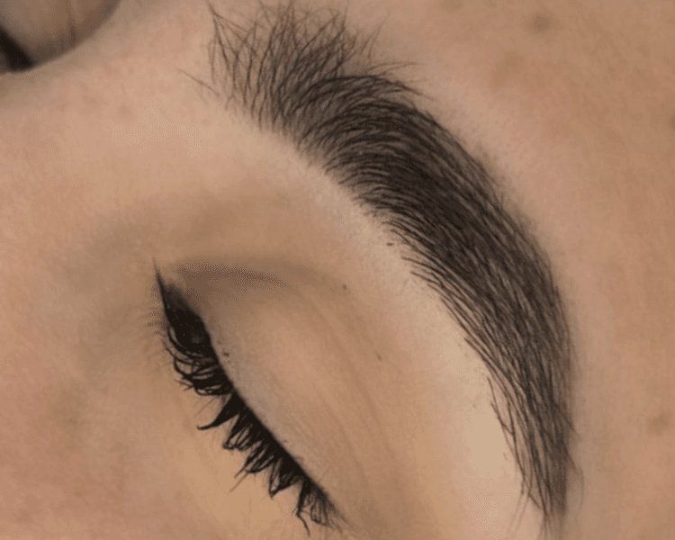 Bioestimulación folicular