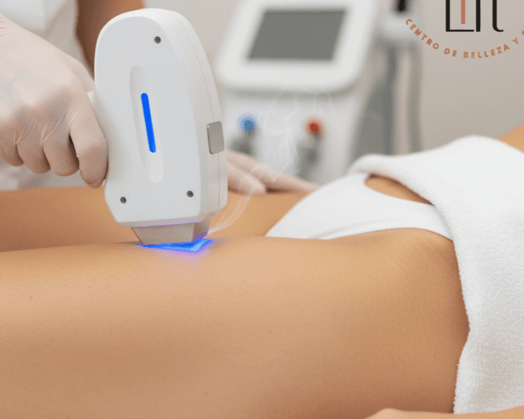 Diodo Entrepierna 1 sesión