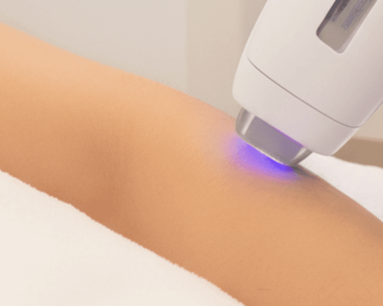 Diodo Bikini Caballero 1 sesión