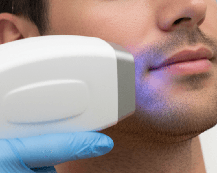 Diodo Rostro Completo 1 sesión