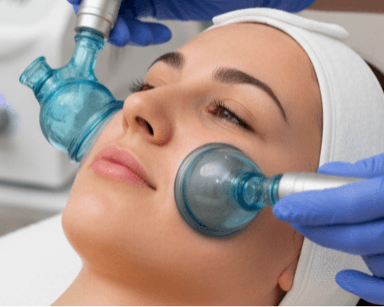 Vacumterapia Facial