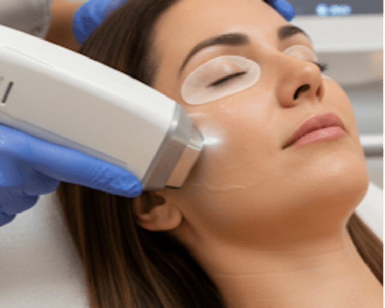 Hifu Facial + aparatología 1 sesión