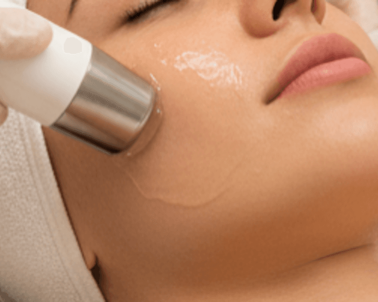 Ultrasonido Facial 1 sesión